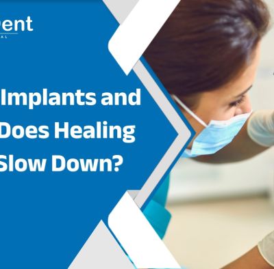 Dental Implants and Aging: Does Healing Really Slow Down?