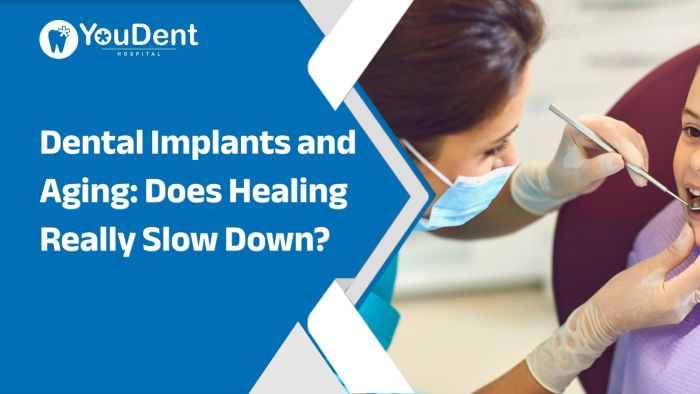Dental Implants and Aging: Does Healing Really Slow Down?
